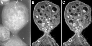 Magnification of a budding yeast.