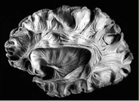 ArcuateFasciculus13.jpg