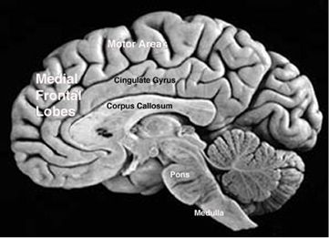 MedialFrontalLobe345.jpg