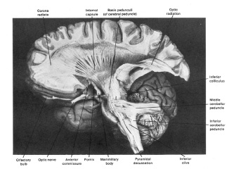 BrainStem1111.jpg