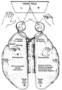 hemishererightleftsplit.jpg