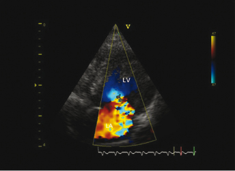 c18-fig-0004