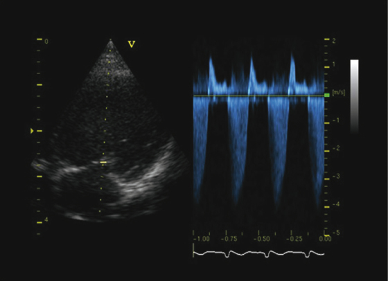 c18-fig-0005