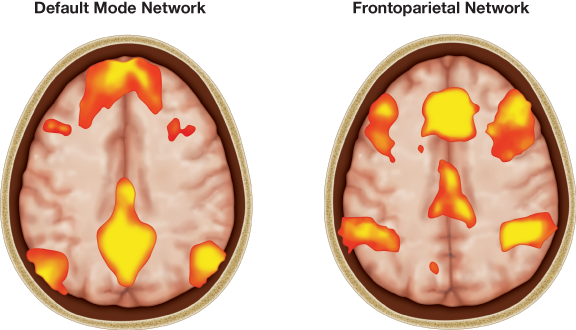 A two-part image that illustrates brain areas of default mode network and frontoparietal network.