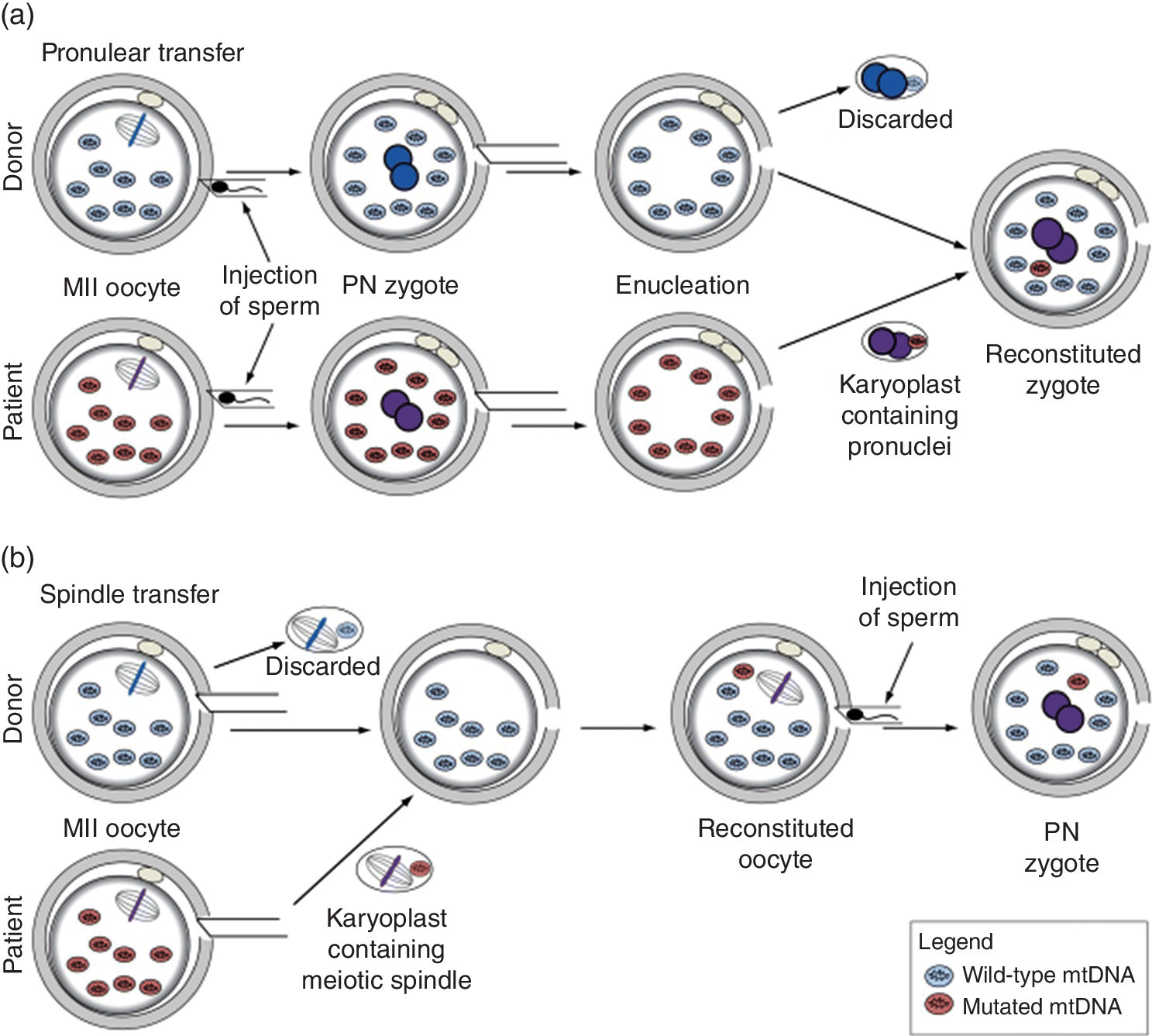 Schematic diagram illustrating methods for mitochondrial donation: pronuclear transfer (top) and spindle transfer (bottom). The diagram starts with MII oocyte and ends with zygote, from a donor and a patient.