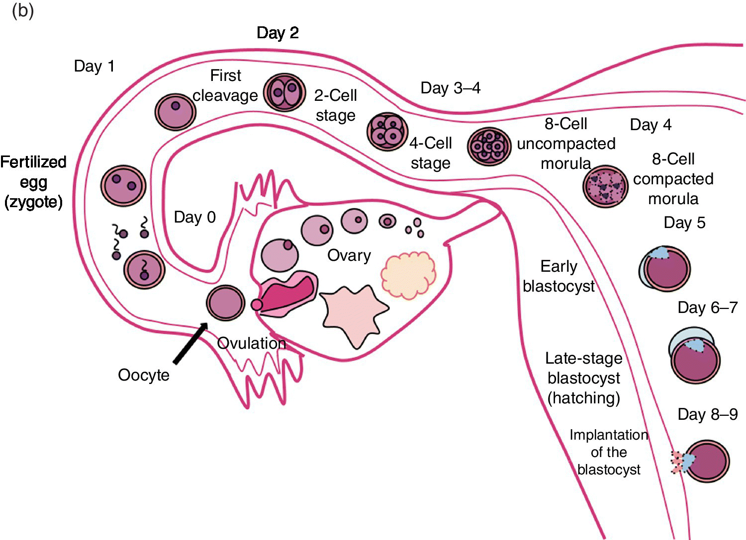 Diagram of the uterus and the fallopian tube illustrating human development from fertilization to implantation of blastocyst.