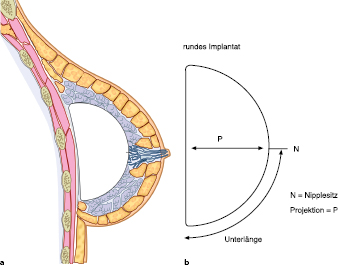 A978-3-662-57390-7_18_Fig1_HTML.jpg