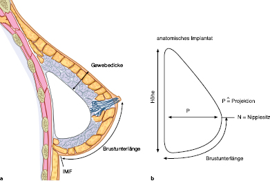 A978-3-662-57390-7_18_Fig2_HTML.jpg