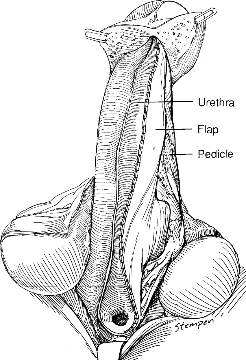 A978-1-59745-103-1_15_Fig2_HTML.jpg