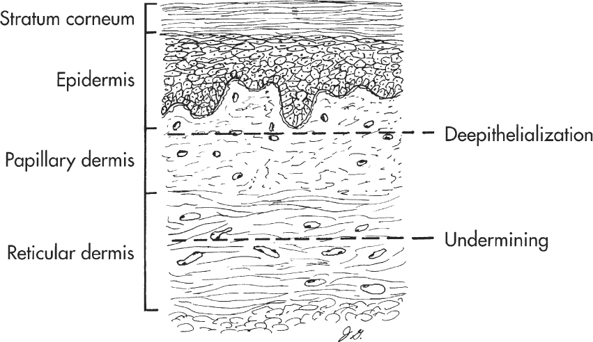 A978-1-59745-103-1_5_Fig2_HTML.jpg