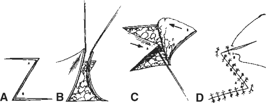 A978-1-59745-103-1_5_Fig9_HTML.jpg