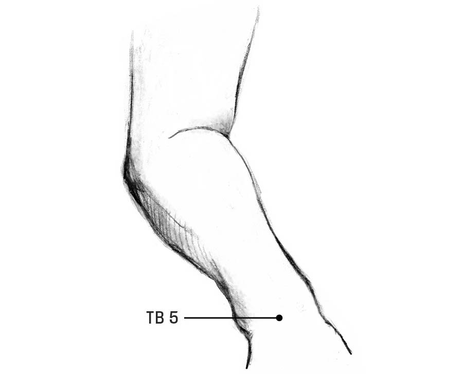 An illustration of the acupoints on the triple burner meridian on the wrist.