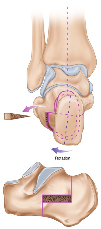 A323556_1_En_11_Fig9_HTML.jpg