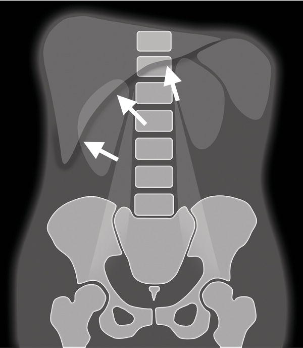 c2-fig-0005