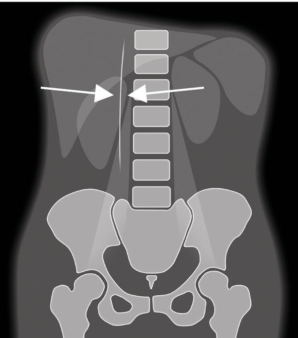 c2-fig-0006