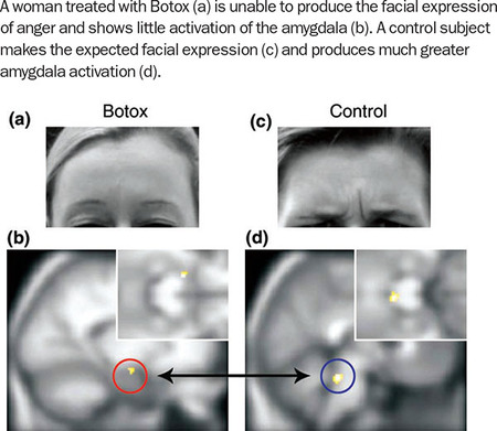 Figure 160