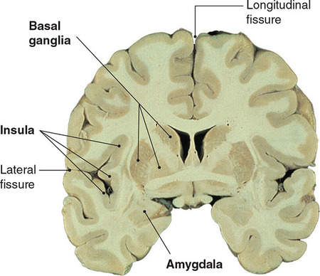 Figure 162