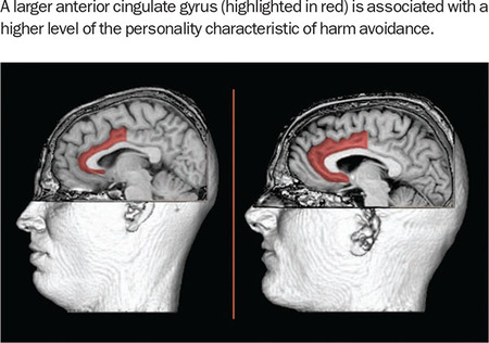 Figure 163