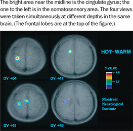 Figure 176