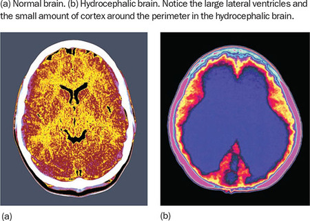 Figure 301