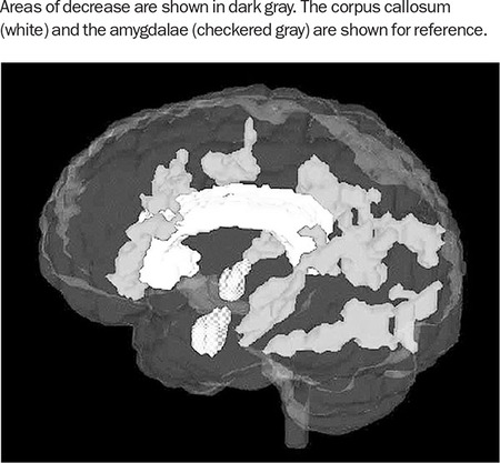 Figure 304