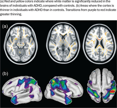 Figure 309