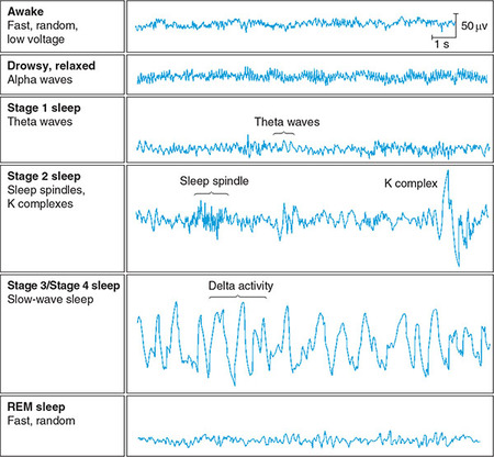 Figure 348