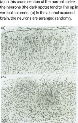 Figure 63