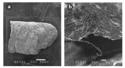 Figure 3 Scanning electron microscope images of the material 'implanted' in James Basil's mouth. (a) Low magnification view of entire 'implant'– scale marker indicates 0.5 mm. (b) Higher magnification view showing small fibre – scale marker indicates 0.005 mm.