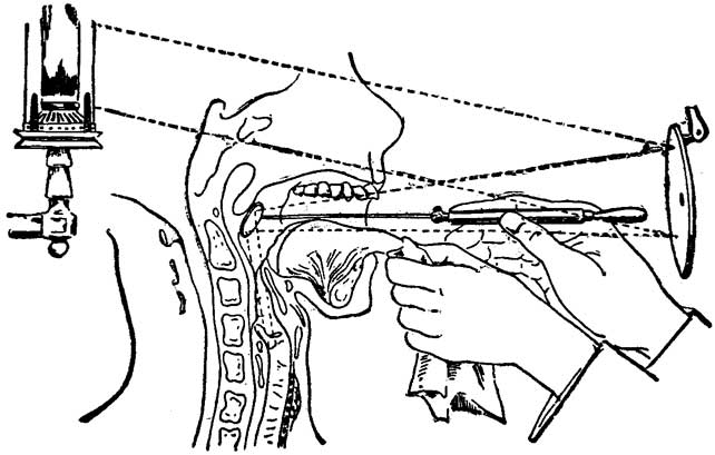 Fig. 38