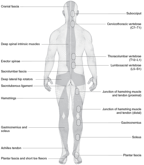 Figure 5.1c Back muscle-tendon regions.