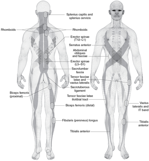 Figure 5.1e Deep muscle-tendon regions.