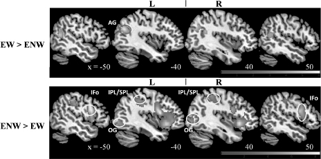 Figure 17.3 Sagittal slices demonstrating subtractions across word and non-word reading conditions in English (FDR corrected, p < 0.05, k > 10). The top panel shows regions activated while reading English words in comparison to non-words (EW > ENW) (T = 3.10) and the bottom panel shows regions exhibiting higher activity while reading English non-words in comparison to words (ENW > EW) (T = 2.85). English words showed higher activity in the left angular gyrus (AG) whereas English non-words showed higher activity in the bilateral inferior frontal operculum (IFo), parietal lobules (IPL/SPL) and the occipital region (OG).