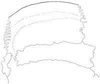 Skull sutures