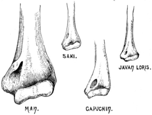 Perforation of the humerus in three species of Quadrumana and in Man.