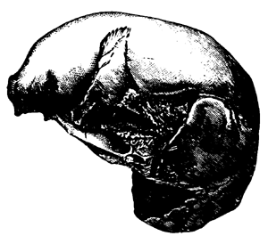 Engis Skull.