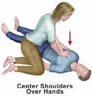 An illustration showing the proper way to perform hands-only CPR with a woman pushing down on a man's chest.