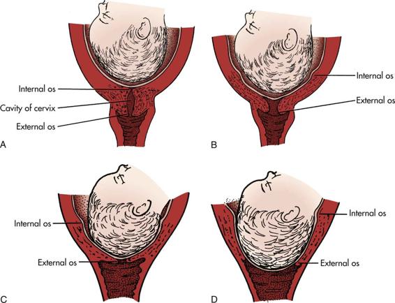 Fig. 6.2