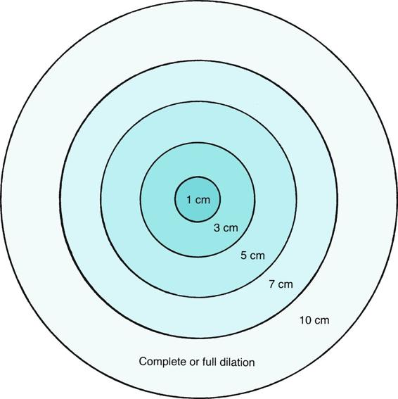 Fig. 6.3