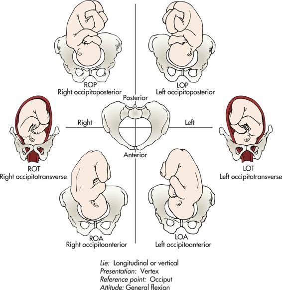 Fig. 6.8