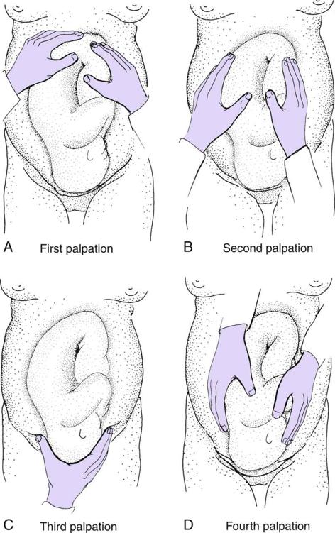 Fig. 6.11