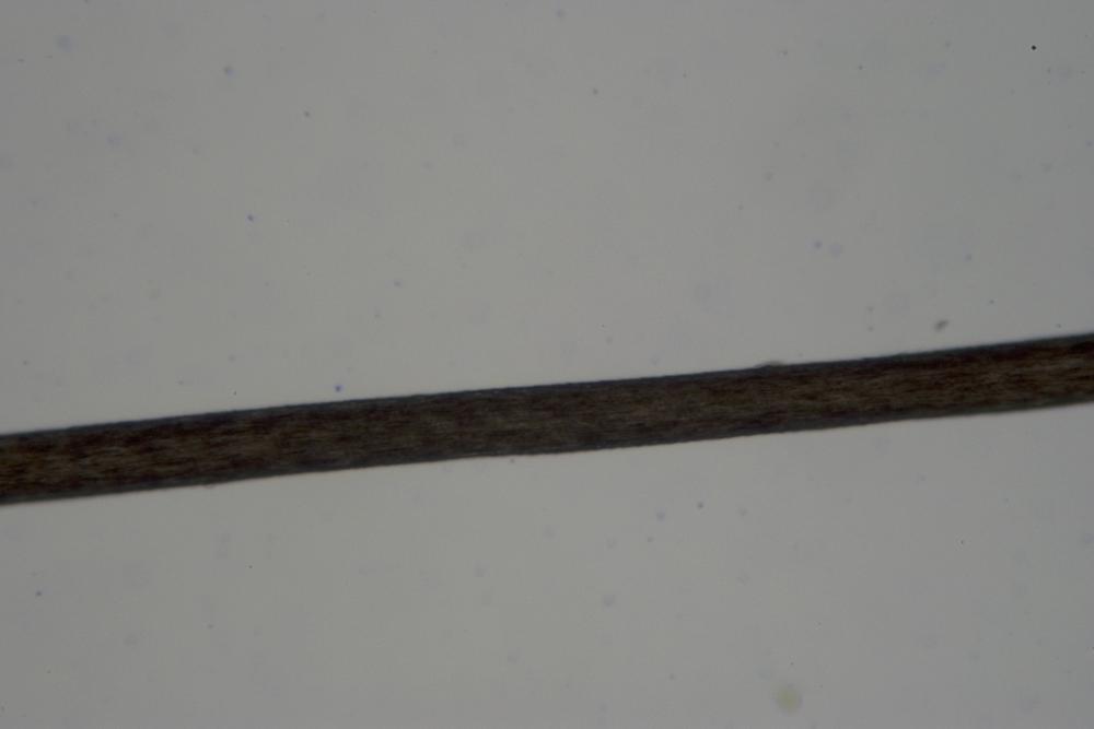 A human scalp hair at 100X