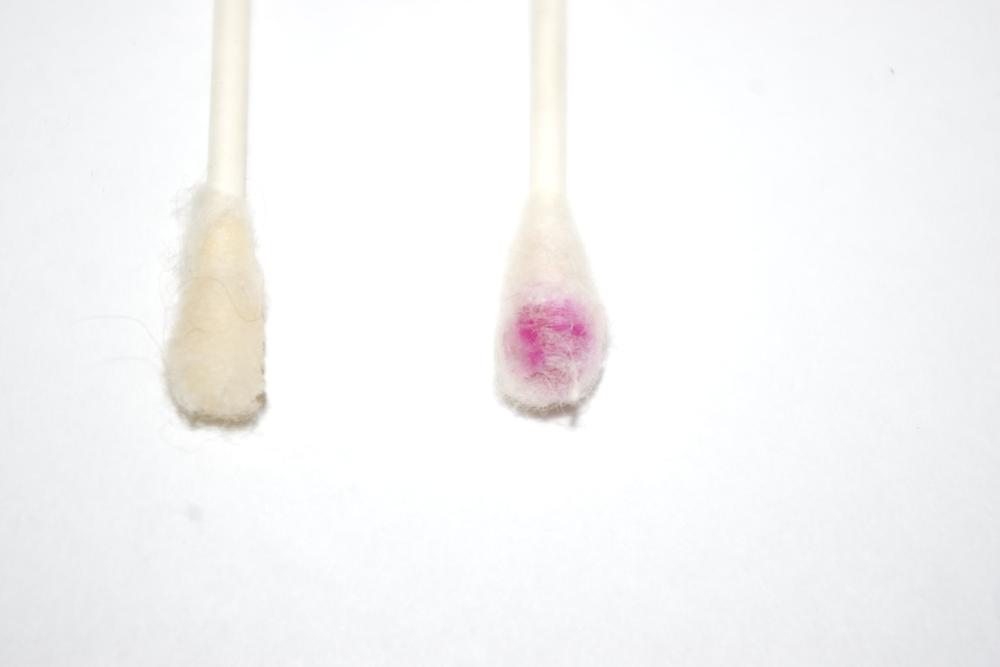 Swabs showing negative (left) and positive KM tests for blood