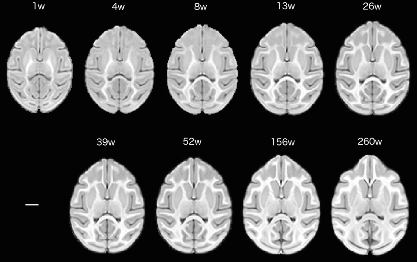 ../images/461857_1_En_14_Chapter/461857_1_En_14_Fig2_HTML.png