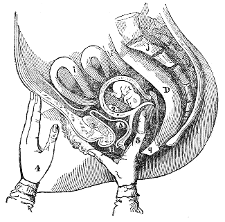 mode of performing the Ballotment