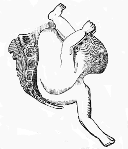 left cephalo iliac position