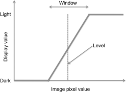 Figure showing Window and level.