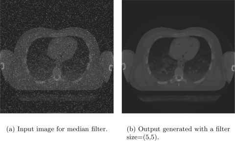 Example showing of median filter.