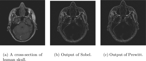 Figure showing Example for Sobel and Prewitt.