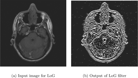 Example showing of LoG.